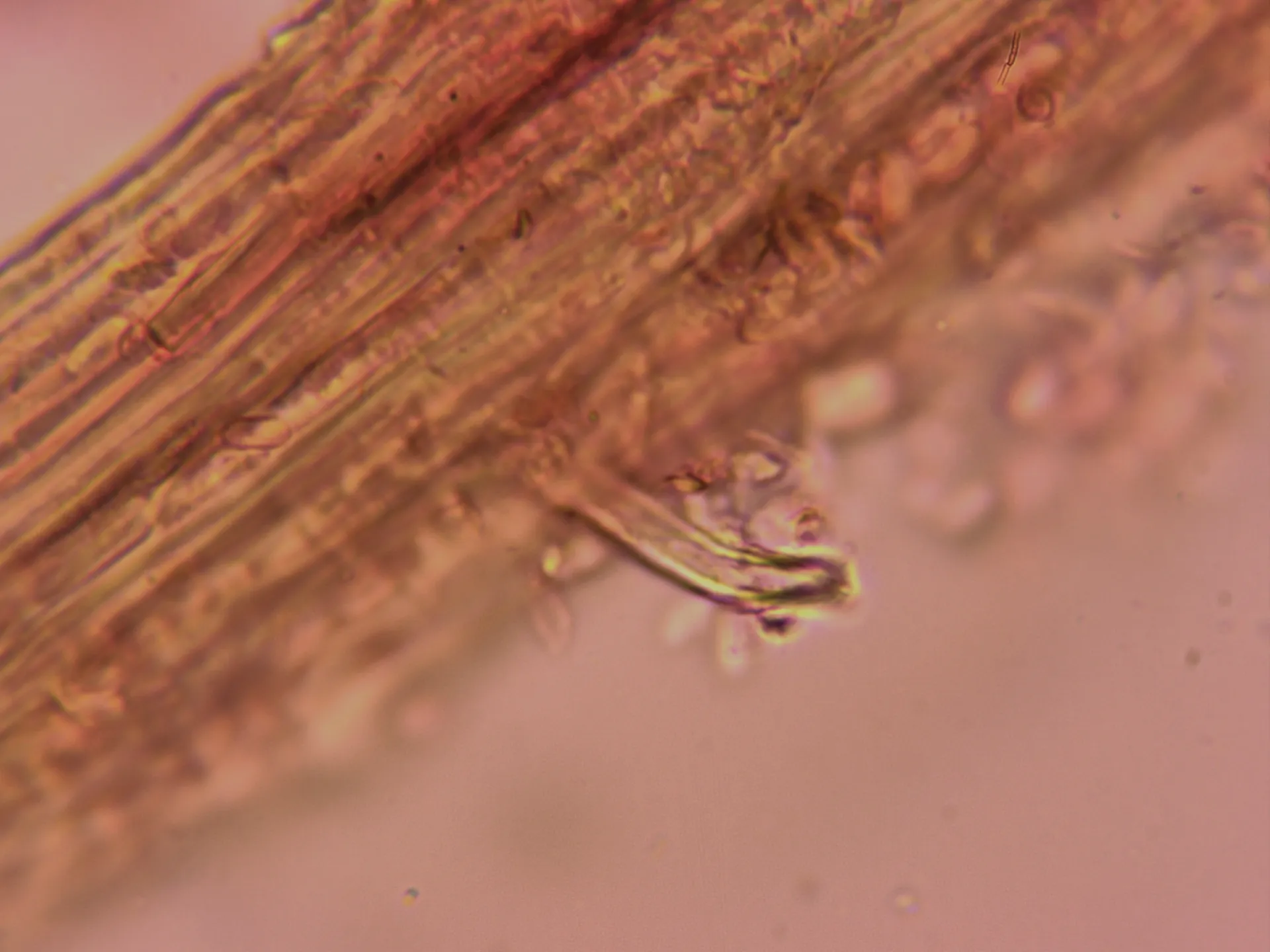 Microscopía de Strobilurus stephanocystis - 10 - Caulocistidio